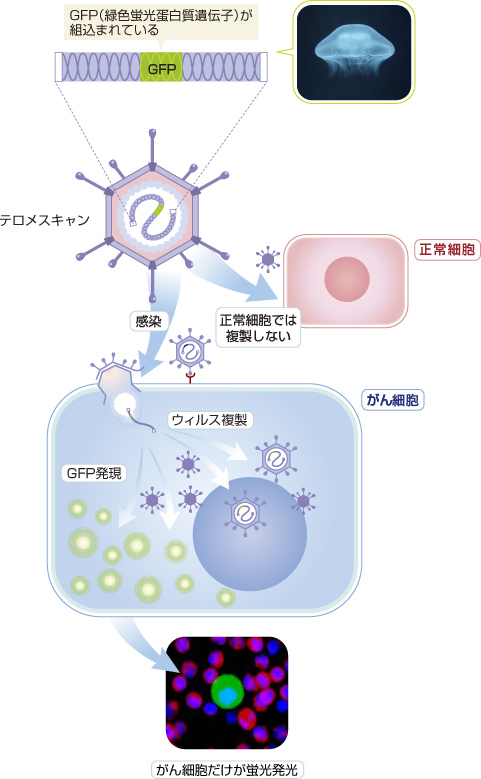 テロメスキャンのメカニズム